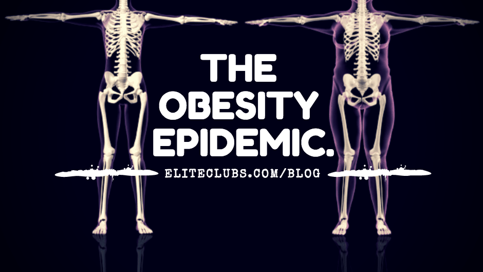 The Obesity Epidemic.