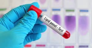 Blood-Lipid-Panel-test